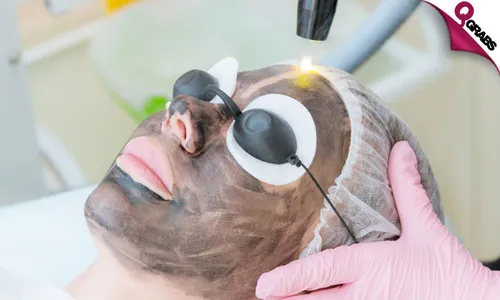 Carbon Laser Facial Treatment!